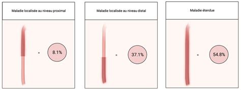Phénotypage histologique de l’œsophagite à éosinophiles - Universimed ...