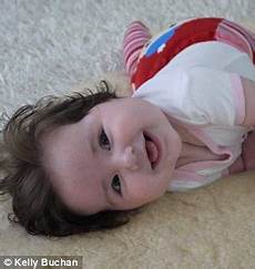 Newborn Without Hair by Baby Born With Of Hair Daily Mail Newborn Without Hair