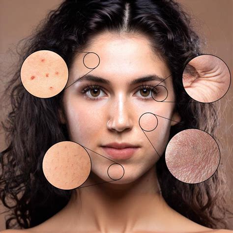 How collagen supplements helps in replacing dead skin cells – NewYou