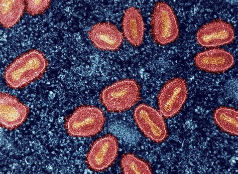Chickenpox: ఈ లక్షణాలు కనిపిస్తే జాగ్రత్త.. పెరిగిపోతున్న ఆ అంటువ్యాధి ...