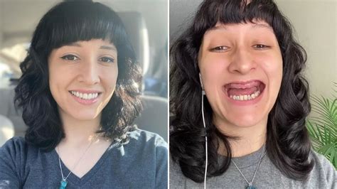 I can finally smile after all my teeth rotted away and I was forced to get dentures at just 29 ...