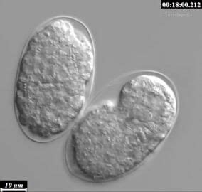 Time-Lapse of Live Developmental Apoptosis in C.elegans Embryogenesis ...