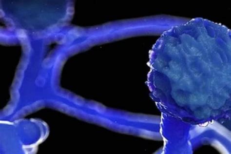 Khammam: జిల్లాను వెంటాడుతున్న బ్లాక్ ఫంగస్.. పెరుగుతున్న బాధితుల సంఖ్య ...