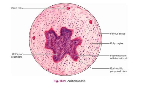 Buy Manual Of Oral Histology And Oral Pathology Color Atlas And Text ...