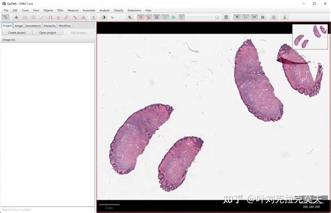 QuPath Tutorial 的图像结果