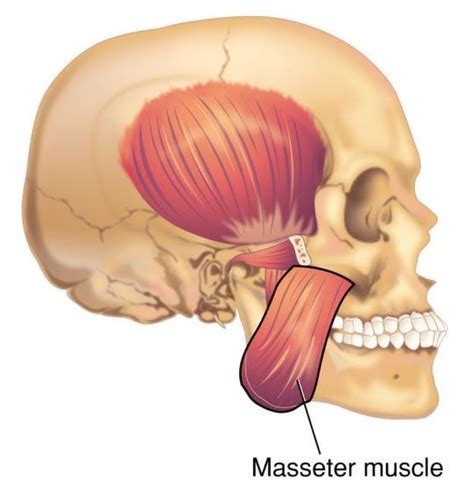Image result for Masseter Muscle Trigger Point