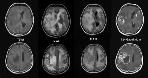 Image result for Deep Learning for Object Classification
