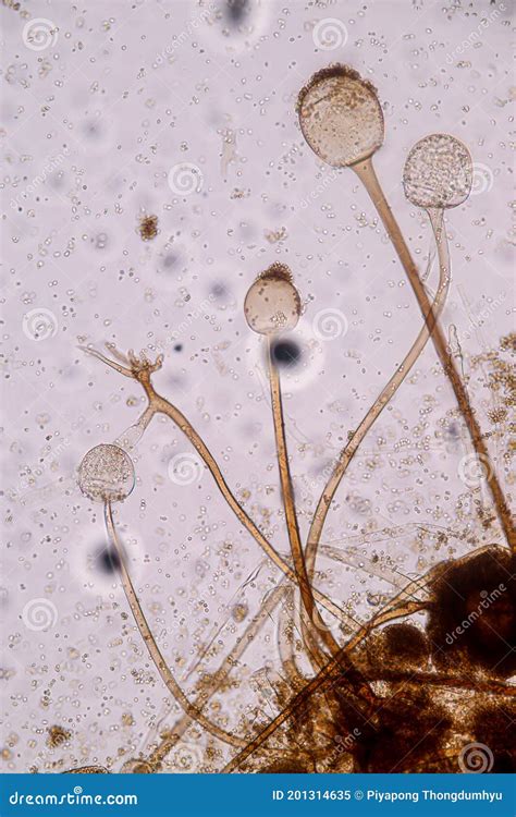 Slide De Rhizopus Stolonifer