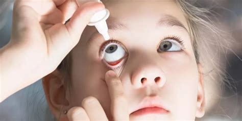 儿童使用眼药水和眼药膏的注意事项 - 上海星晨儿童医院-官网