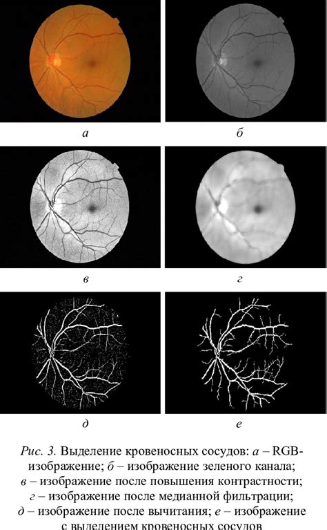 Image result for Normal Blood Segmenter Values