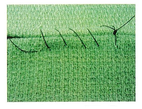 Image result for Continuous Suture Patterns