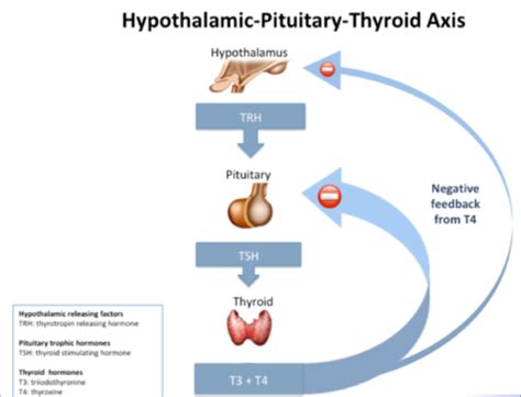 Image result for hyperthyroidism