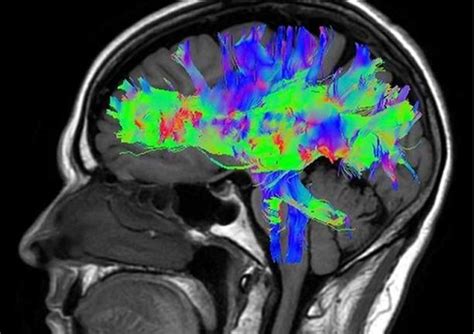 Image result for fMRI Python