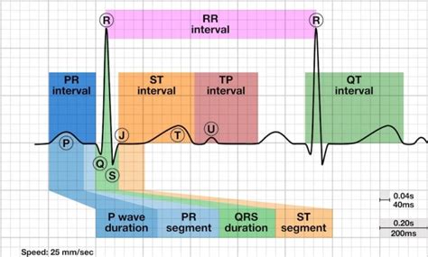Image result for PR Interval Normal Range