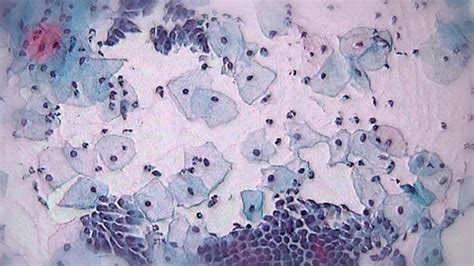 Image result for Pap Test Animation