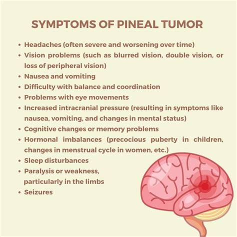 Pineal Cyst Symptoms