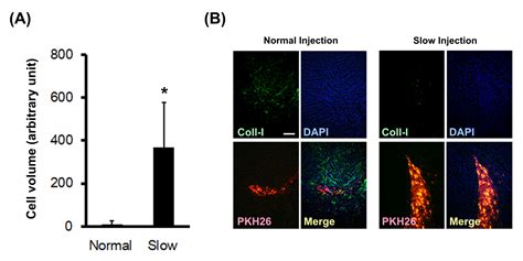 Image result for Spring Based Non-Invasive Injection