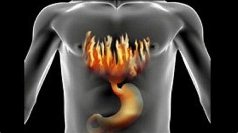 अॅसिडीटीवर हे ७ घरगुती उपाय रामबाण ठरतील! I Acidity I Home Remedies I ...