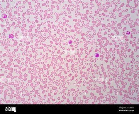 Blood Cells Under Microscope Quiz at Lilly Hoover blog