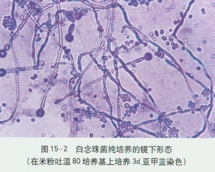 孟加拉红（虎红）琼脂-白色念珠菌 - 霉菌和酵母菌 - 北京陆桥技术股份有限公司
