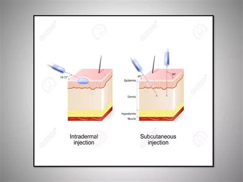 Intradermal & Subcutaneous Injection.pptx