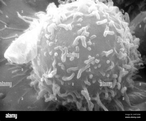 Image result for Lymphocytes Microscopic View