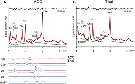 LC Model Spectroscopy Software 的图像结果
