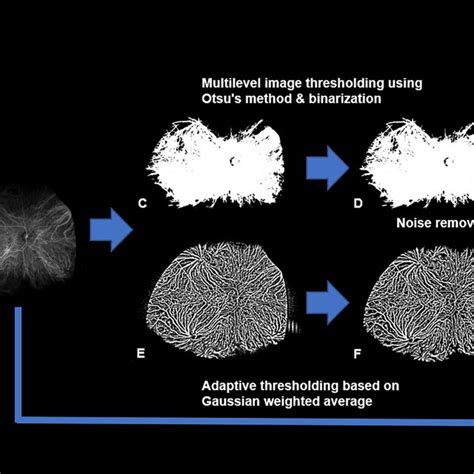 Image result for Image Processing Using ImageJ