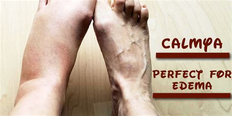 Cure Edema 的图像结果