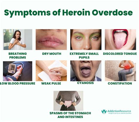 Heroin Overdose: Symptoms, Response and Treatment. Risks of Snorting