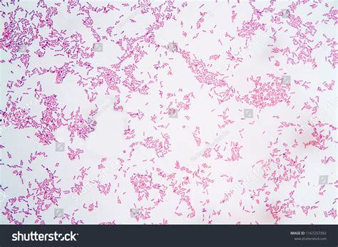 Endospore Rod Bacterial Cells By Gram Stock Photo 1167257392 | Shutterstock