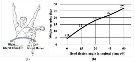 Development of an Automatic Air-Driven 3D-Printed Spinal Posture Corrector