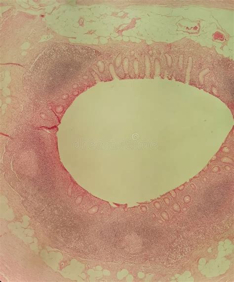 Image result for Appendix Section