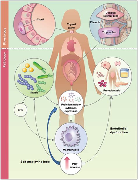 Overview of procalcitonin in pregnancy and in pre‐eclampsia - Mangogna - 2019 - Clinical ...