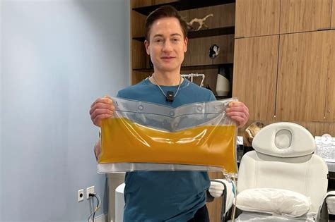 ‘Don’t die’: Who is Bryan Johnson, the millionaire biohacker behind ...