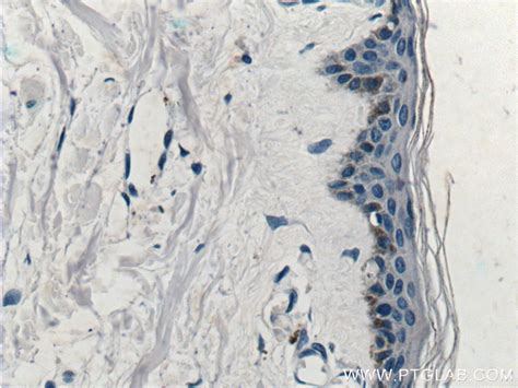 ST6GALNAC1 antibody (15363-1-AP) | Proteintech