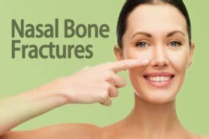 Nasal Bone Fracture - Brain and ENT Clinic - Dr Lalit Mahajan In Nagpur ...