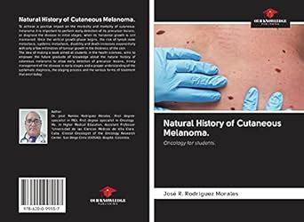 Natural History of Cutaneous Melanoma. : Amazon.in: Books