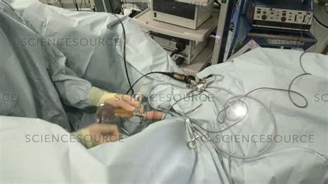 Image result for Turp Procedure Explained