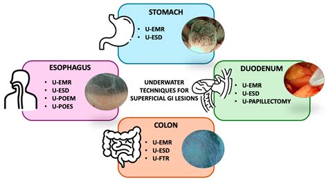 Underwater Techniques in Gastrointestinal Endoscopy: Diving into the Depths