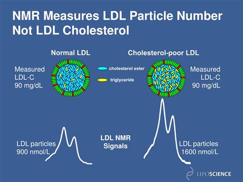 PPT - Unlocking the Mystery of LDL Particle Number in Cardiovascular ...