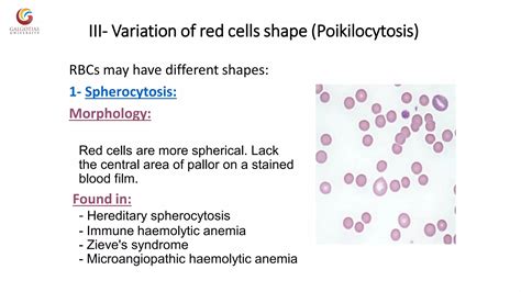 Abnormal morphology of rbc notes | PDF