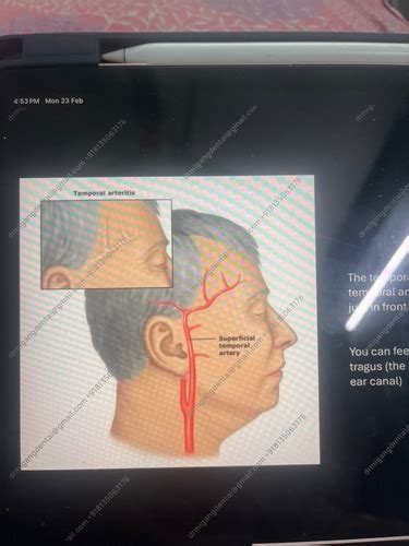 Superficial temporal artery Flashcards | Quizlet
