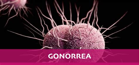 GONORREA – Materno Fetal Tijuana
