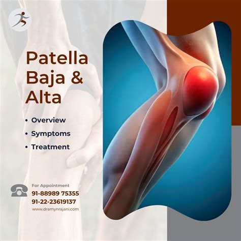 Patella alta - Knee, Shoulder & Hip Surgeon - Orthopaedic Surgery ...