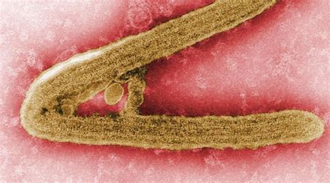 “世界上最可怕的病毒”，马尔堡病毒卷土重来_腾讯新闻