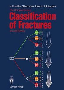 The Comprehensive Classification of Fractures of Long Bones: Buy The ...
