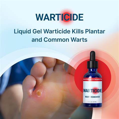 Buy Warticide Fast-Acting Wart Remover - Plantar and Genital Wart ...