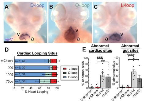 The Axenfeld–Rieger Syndrome Gene FOXC1 Contributes to Left–Right ...