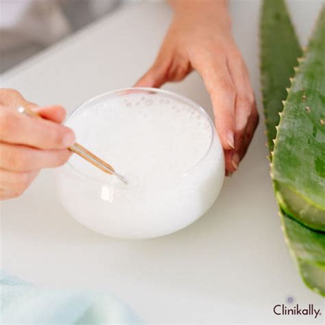 Top Aloe Vera Benefits for Skin and Hair | Clinikally